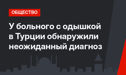 У больного с одышкой в ​​Турции обнаружили неожиданный диагноз