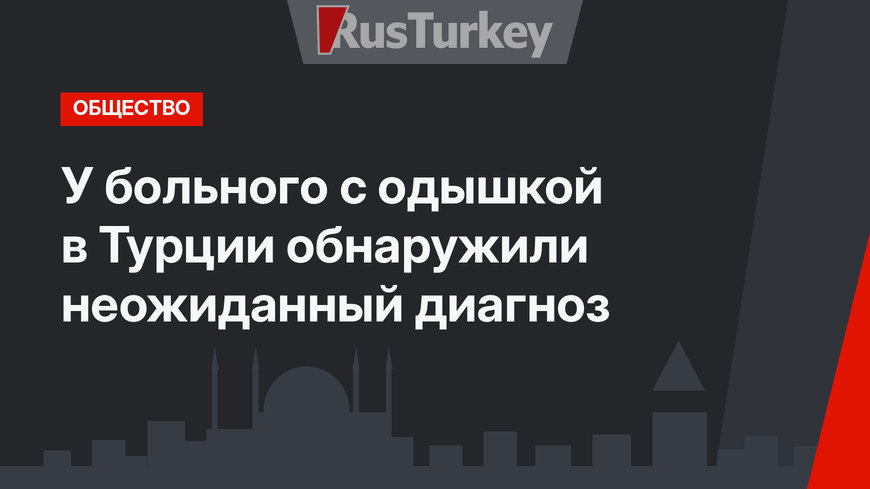 У больного с одышкой в ​​Турции обнаружили неожиданный диагноз