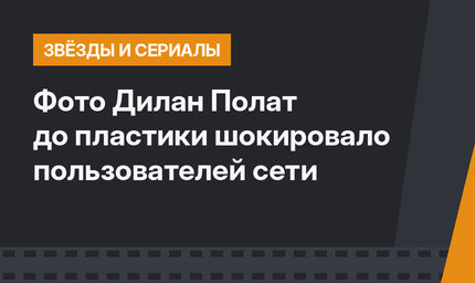 Фото Дилан Полат до пластики шокировало  пользователей сети