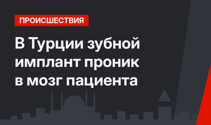 В Турции зубной имплант проник в мозг пациента